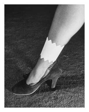 aaaankle5