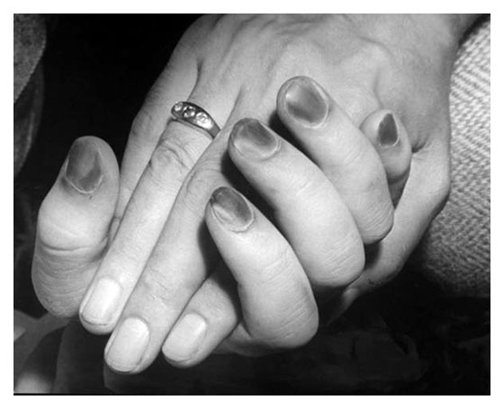 aaahands